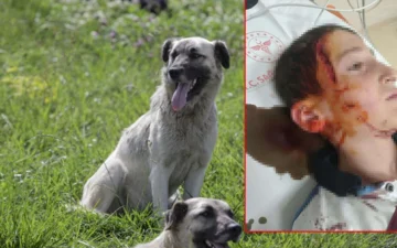 köpek saldırısı