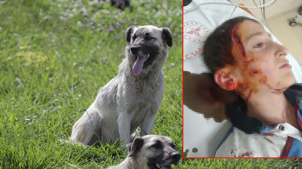 köpek saldırısı